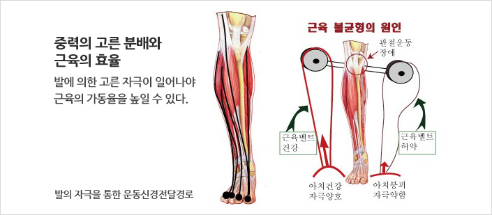 근육불균형